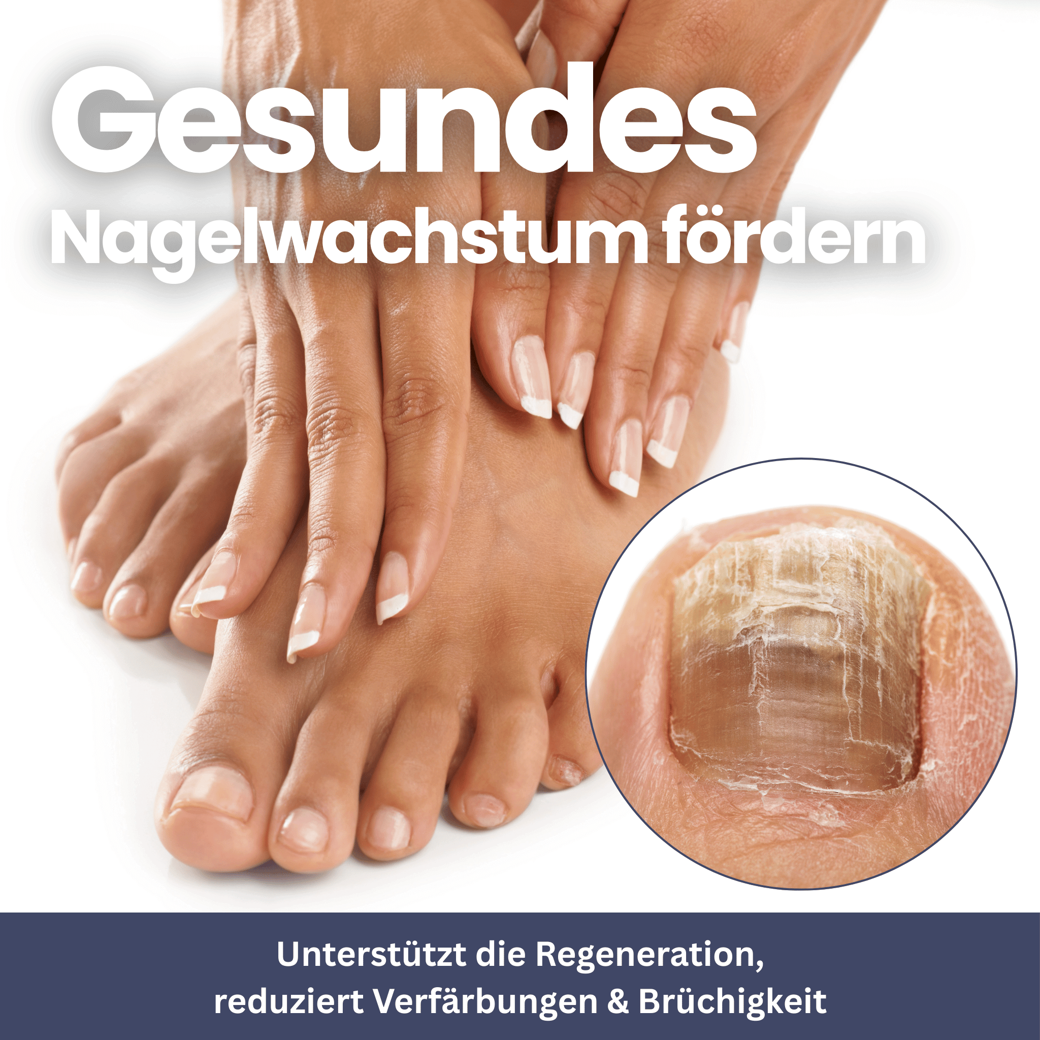 NailClip – Nail Fungus Therapy Device