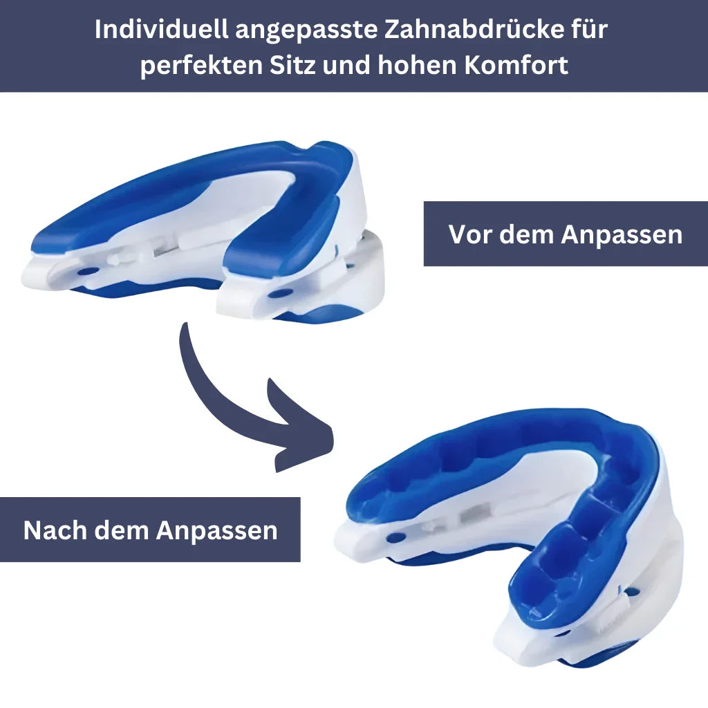 SilentNight – Anti-Snoring & Protrusion Guard