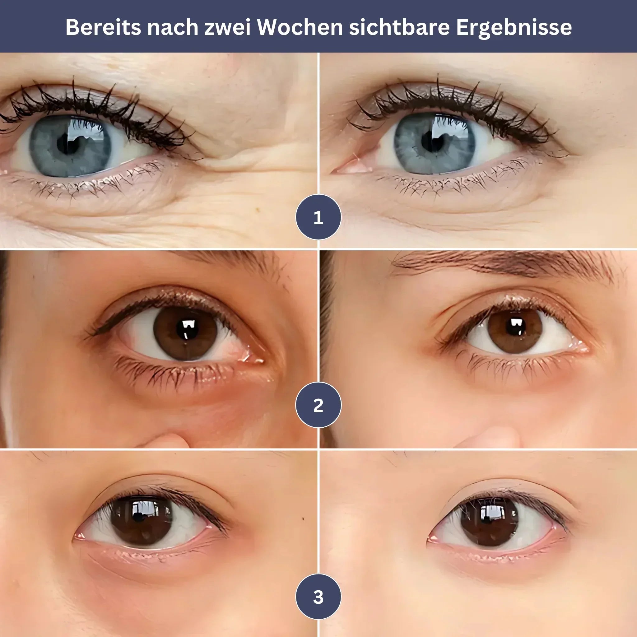 GlowEye – Your Rejuvenation Booster for Radiant Eyes