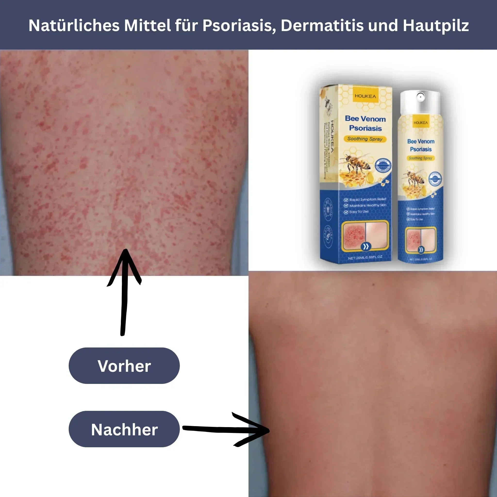 HOUKEA Bee Venom Soothing Spray