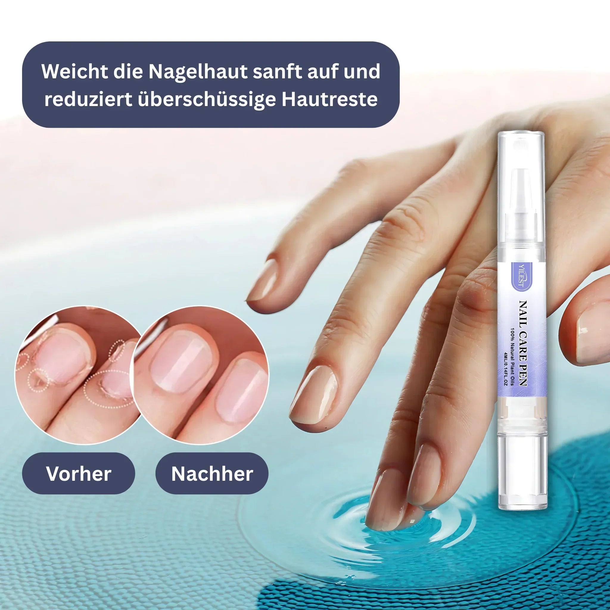 YILEST Natural Nail Care Pen