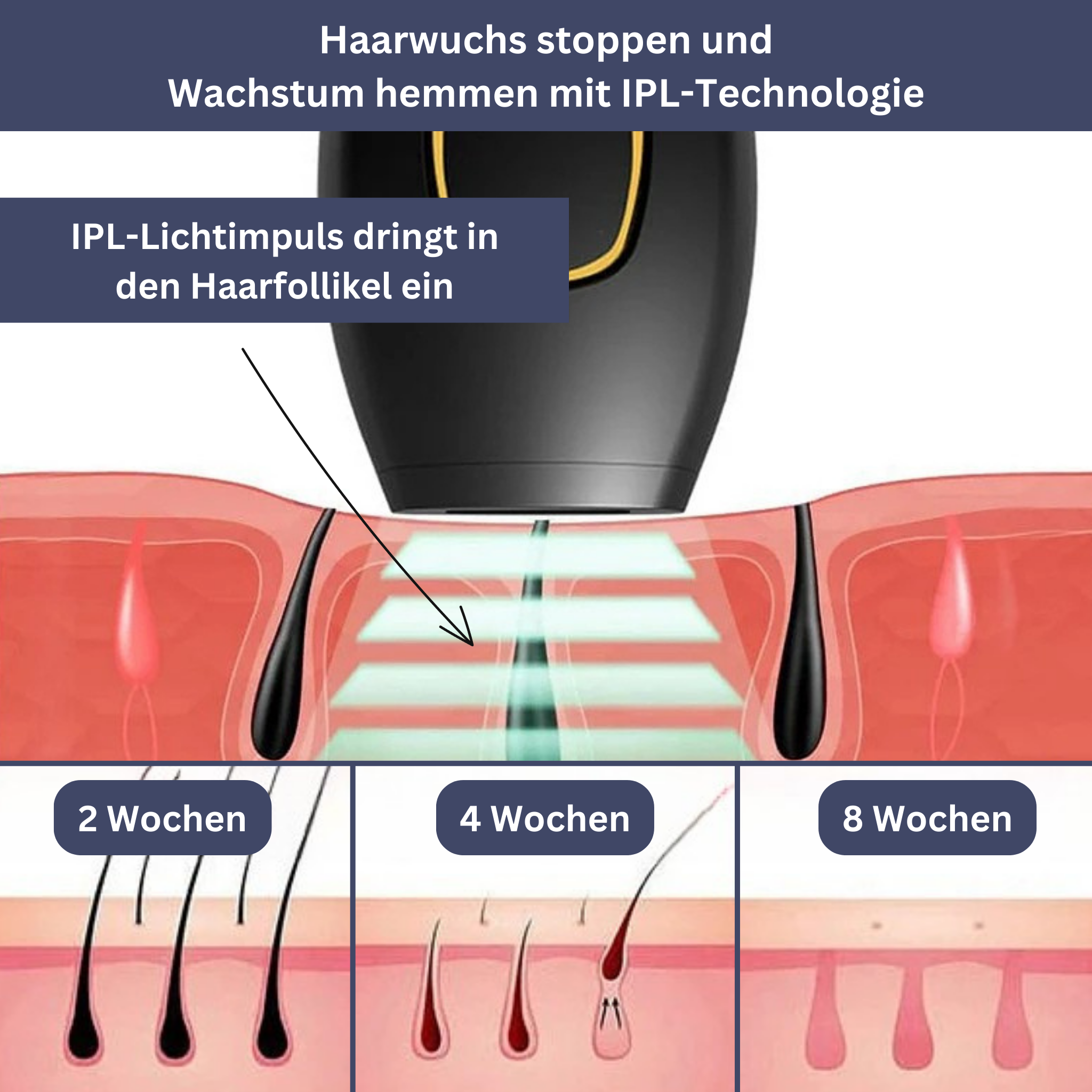 SmoothTouch IPL Epilator