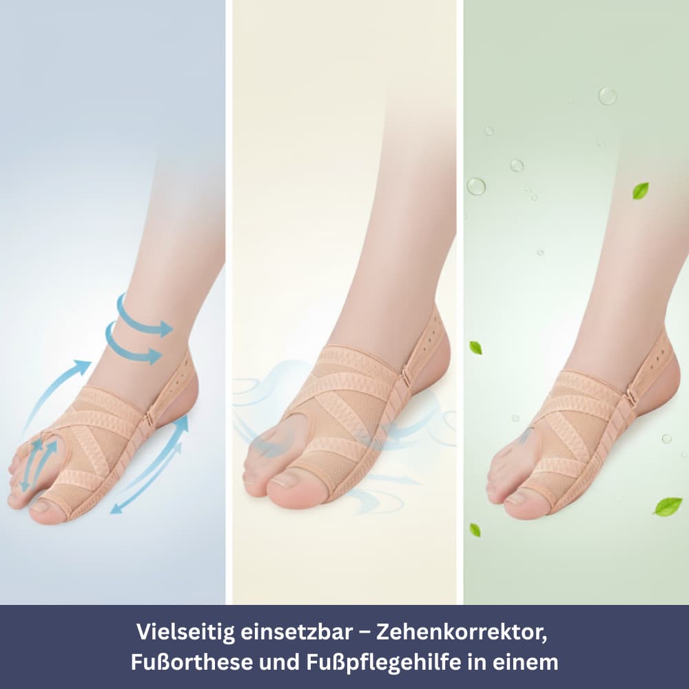 FlexAlign – Hallux Valgus Correction Band
