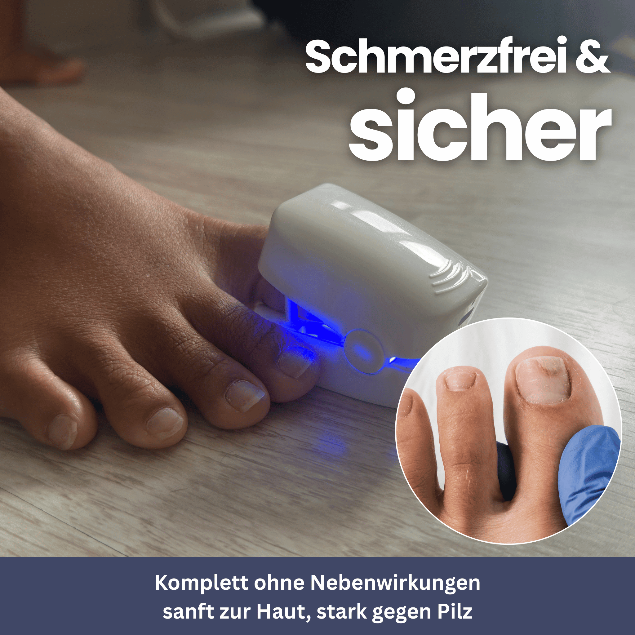 NailClip – Nail Fungus Therapy Device