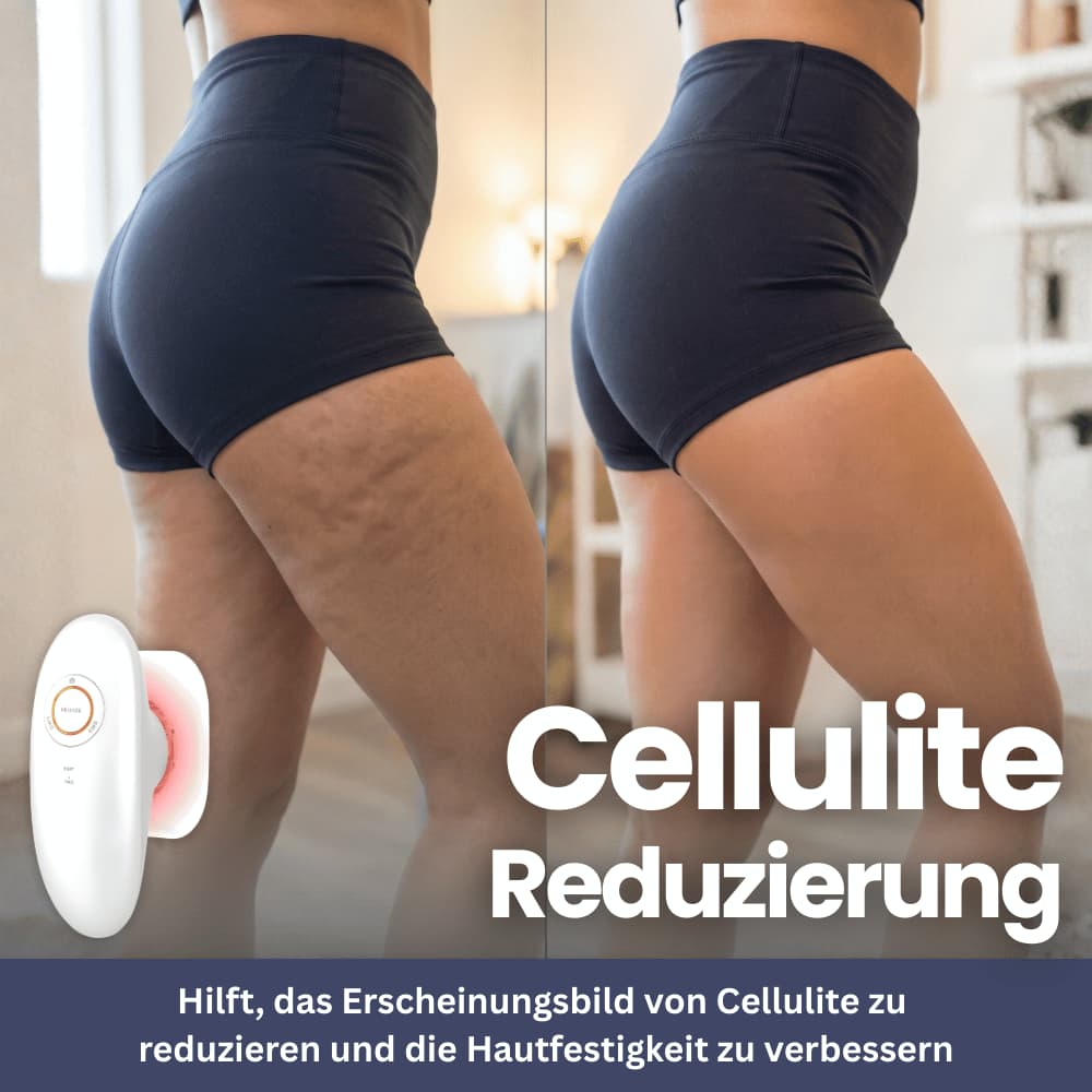 DermaLift Pro – Anti-Cellulite Massager