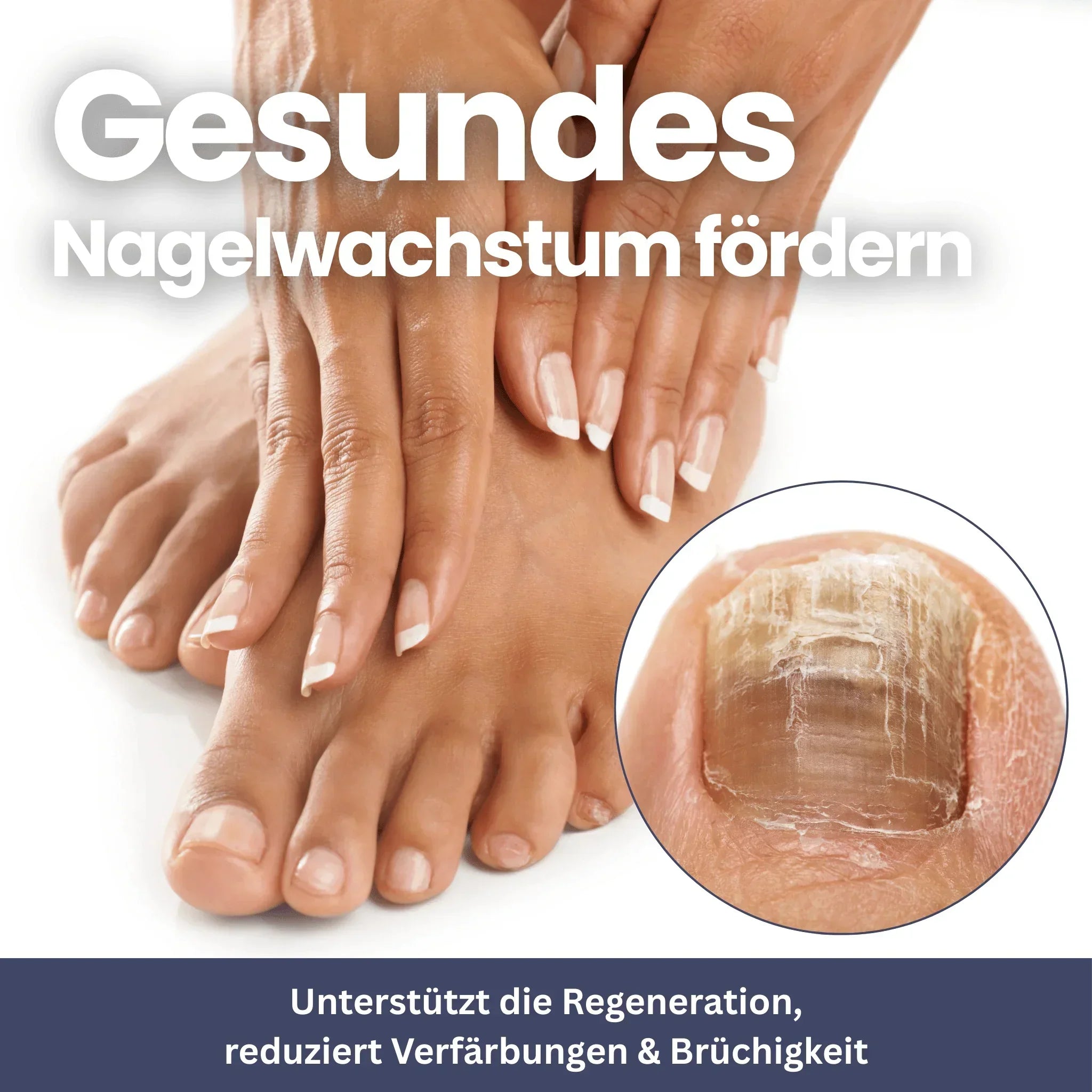 NailClip – Nail Fungus Therapy Device